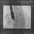   Autor: Uniwersytecki Szpital Kliniczny