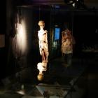 Body Worlds – Vital we Wrocławiu  Autor: Jakub Jurek